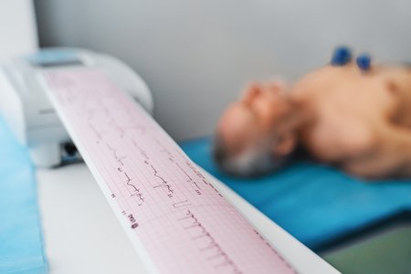 Ein EKG ist schnell durchgeführt und liefert wichtige Informationen über die Aktivität des Herzens. EKG eines Mannes